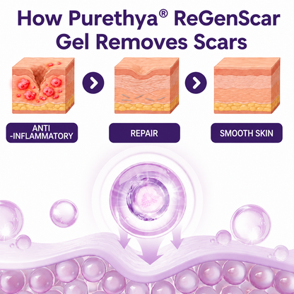 Purethya® ReGenScar Stem Cell Scar Gel